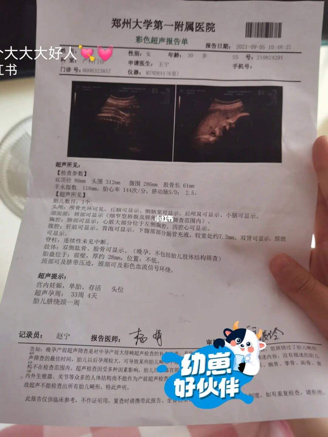 孕妇腿短吃什么补钙的 孕妇腿短吃什么补钙的食物
