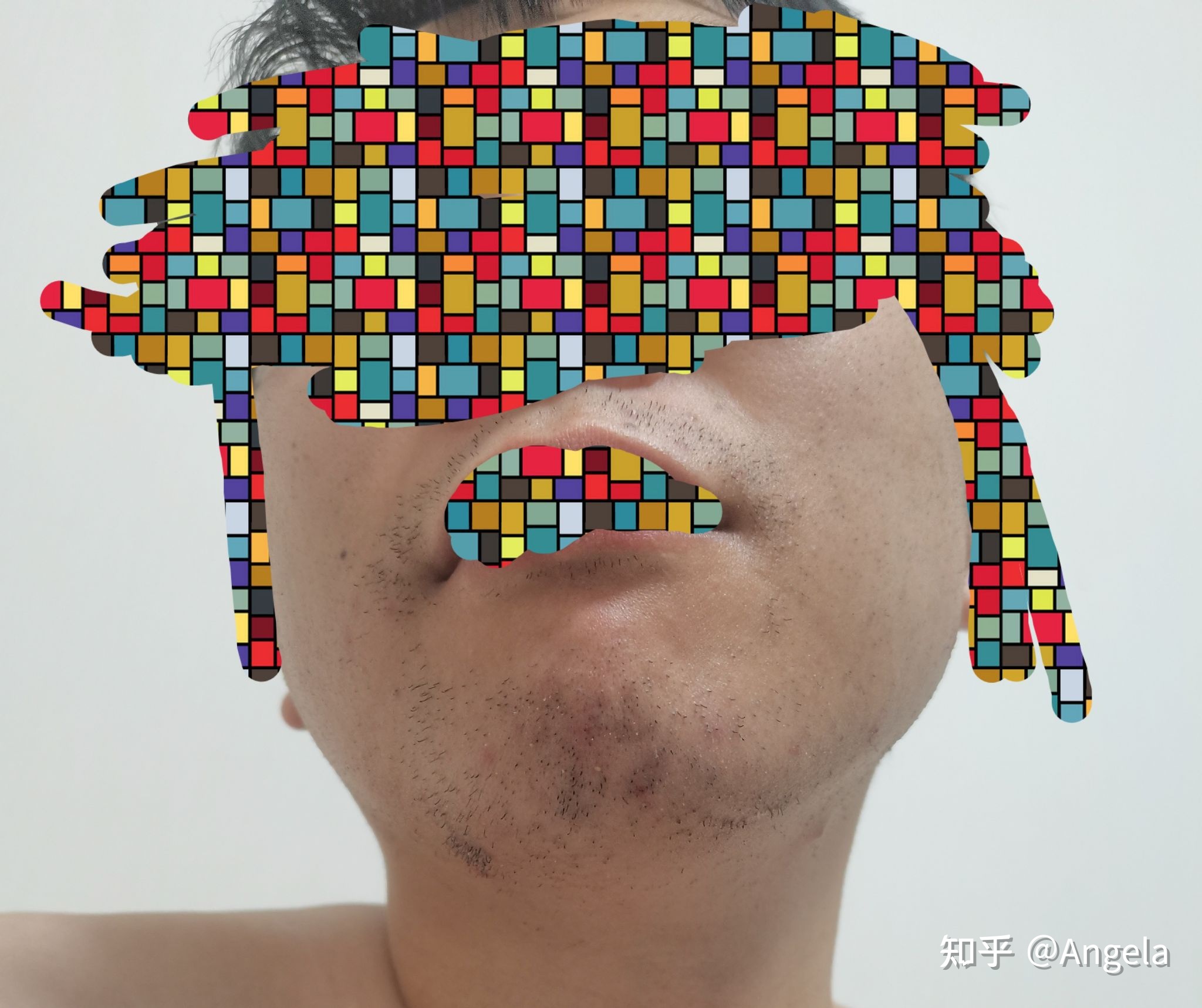络腮胡能不能激光脱完 络腮胡激光对脸有副作用吗